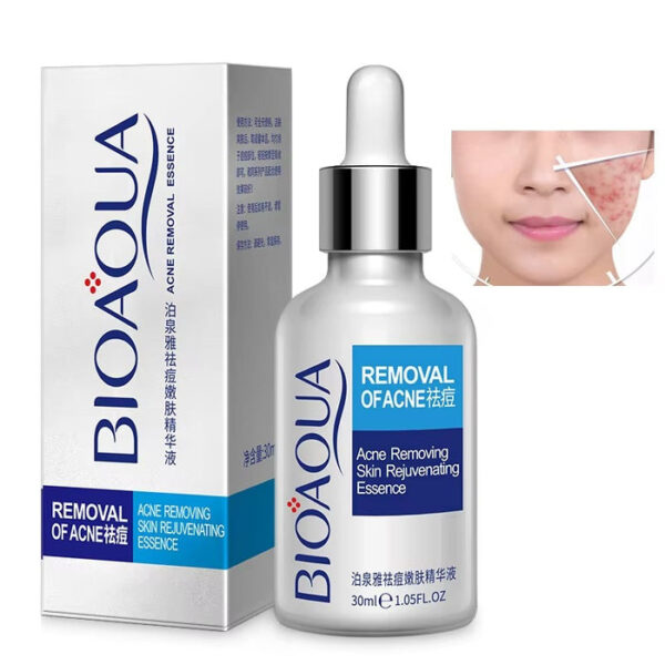 Bioaqua Anti-Acne Serum Removal Of Acne Essence Liquid 30ML - Image 2