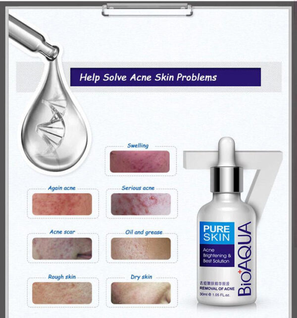 Bioaqua Anti-Acne Serum Removal Of Acne Essence Liquid 30ML - Image 4